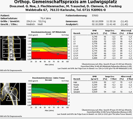 Messwerte der Knochendichte