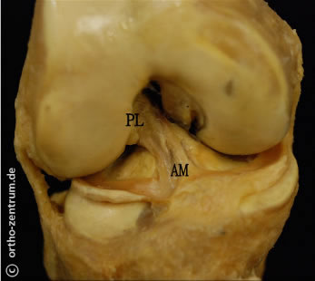 Vorderes Kreuzband